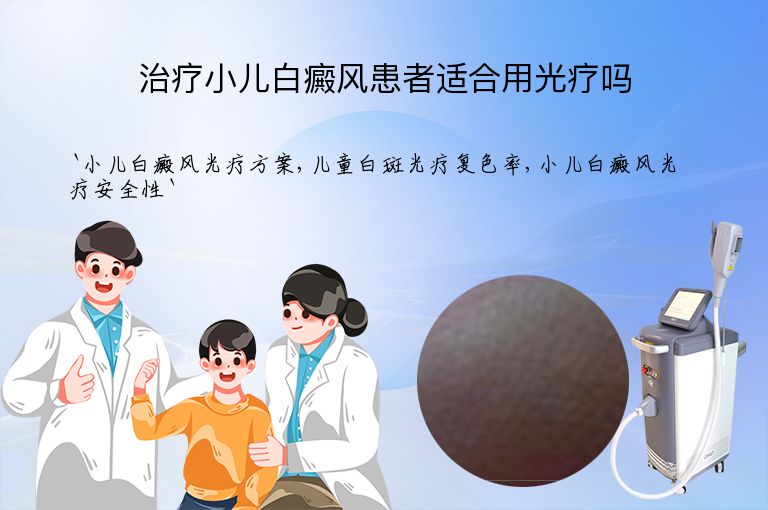 治疗小儿白癜风患者适合用光疗吗