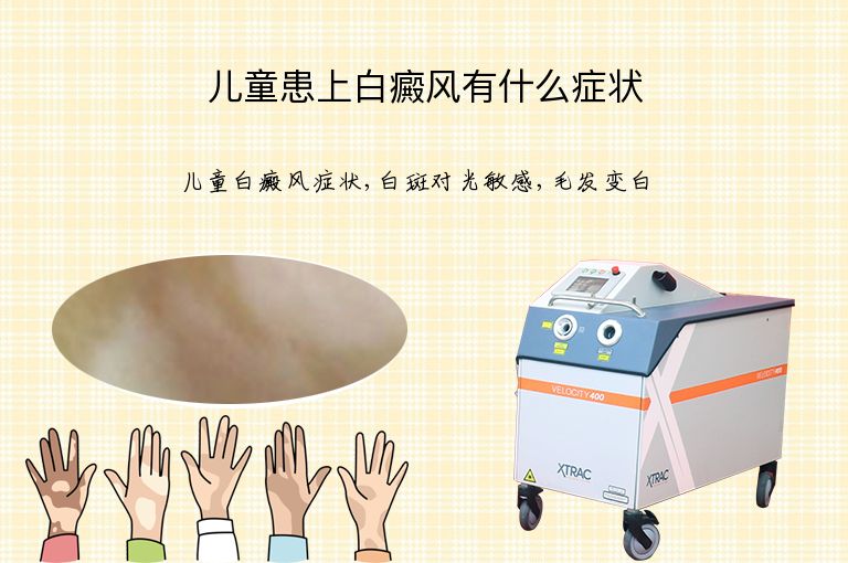 儿童患上白癜风有什么症状”