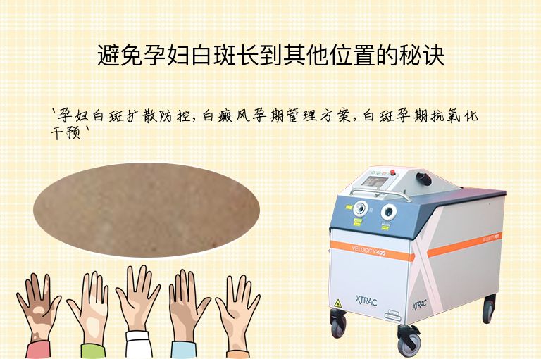 避免孕妇白斑长到其他位置的秘诀