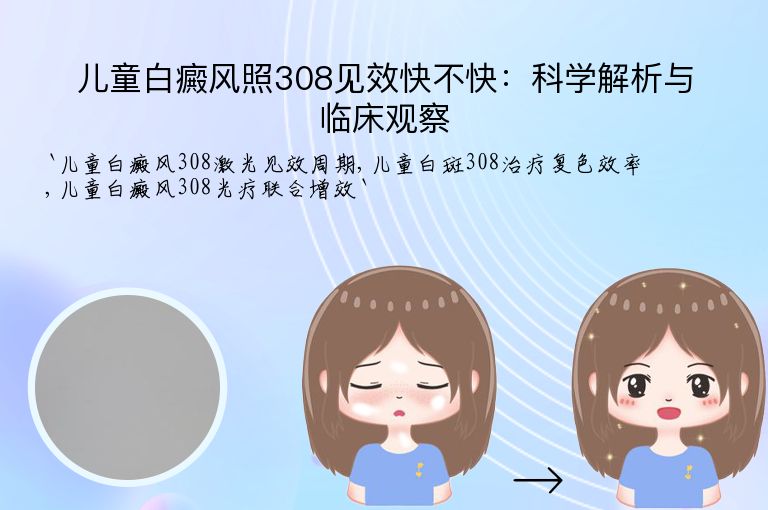 儿童白癜风照308见效快不快:科学解析与临床观察