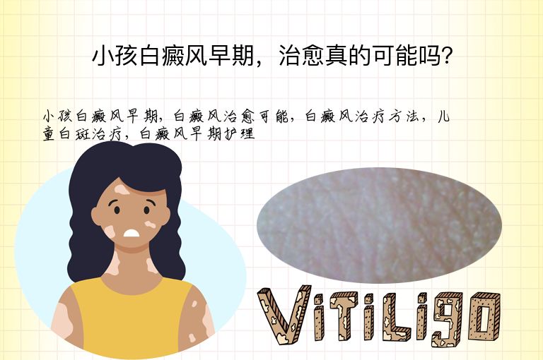 小孩白癜风早期，治愈真的可能吗？”