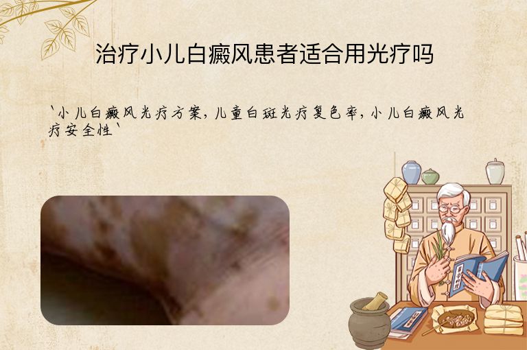 治疗小儿白癜风患者适合用光疗吗