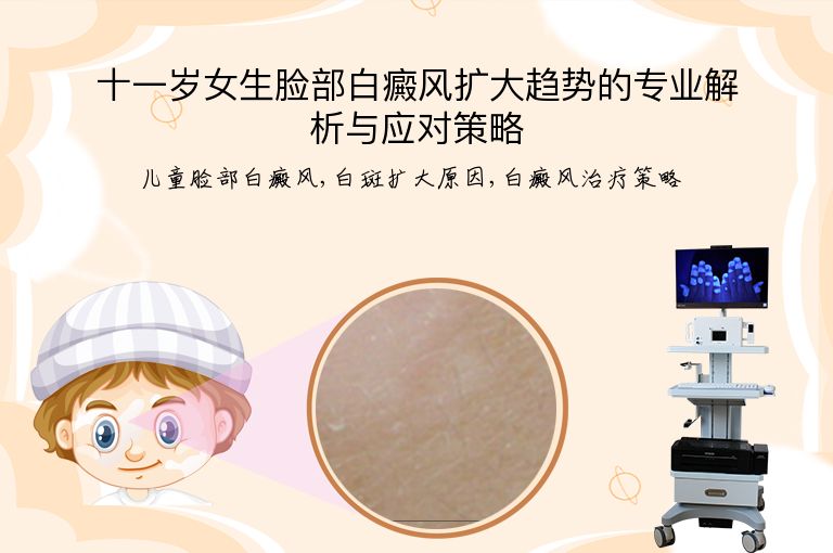 十一岁女生脸部白癜风扩大趋势的专业解析与应对策略”