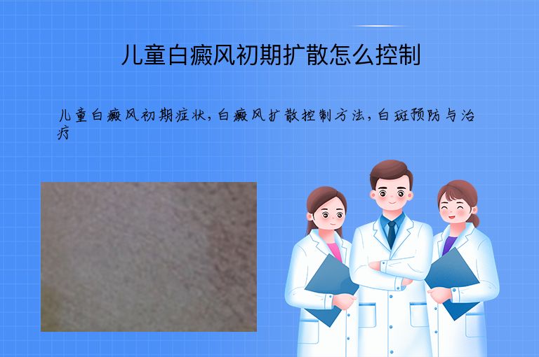 https://www.bdfsjzyy.com/d/file/p/91b5a73c06e9f93942c7c9b1afc068a0.jpeg