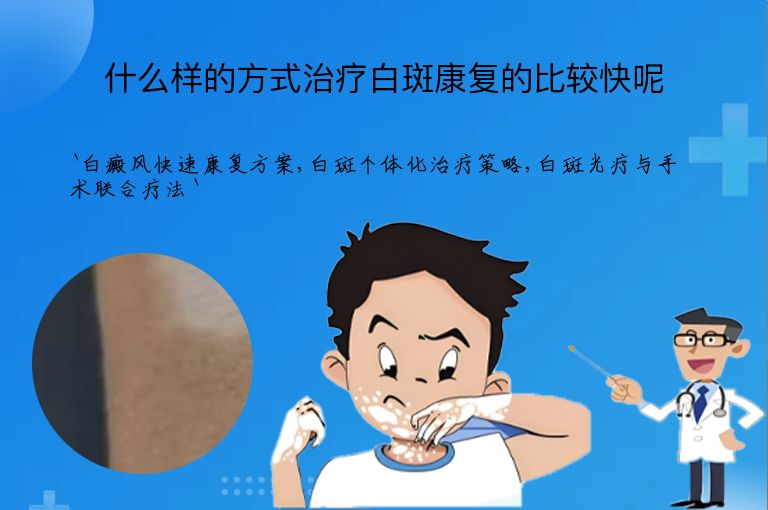 什么样的方式治疗白斑康复的比较快呢