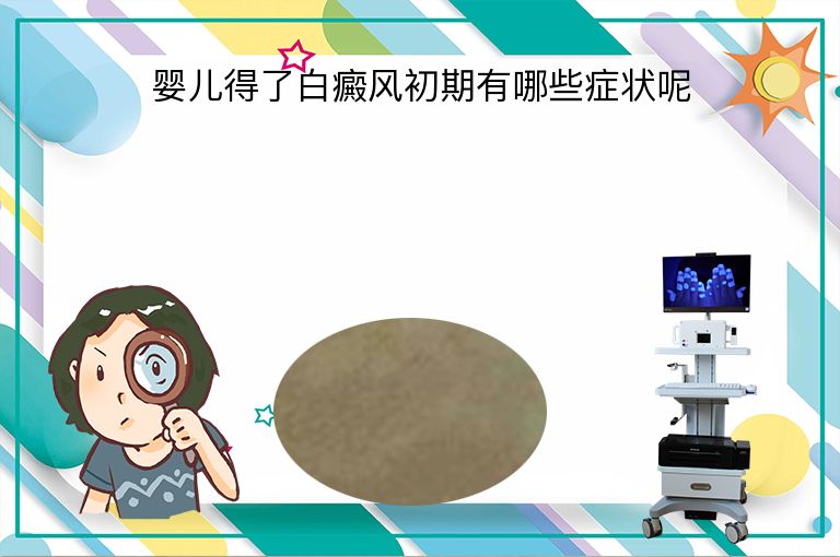 婴儿得了白癜风初期有哪些症状呢