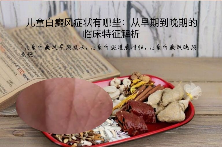 儿童白癜风症状有哪些：从早期到晚期的临床特征解析