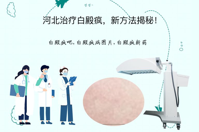 河北治疗白殿疯，新方法揭秘！”