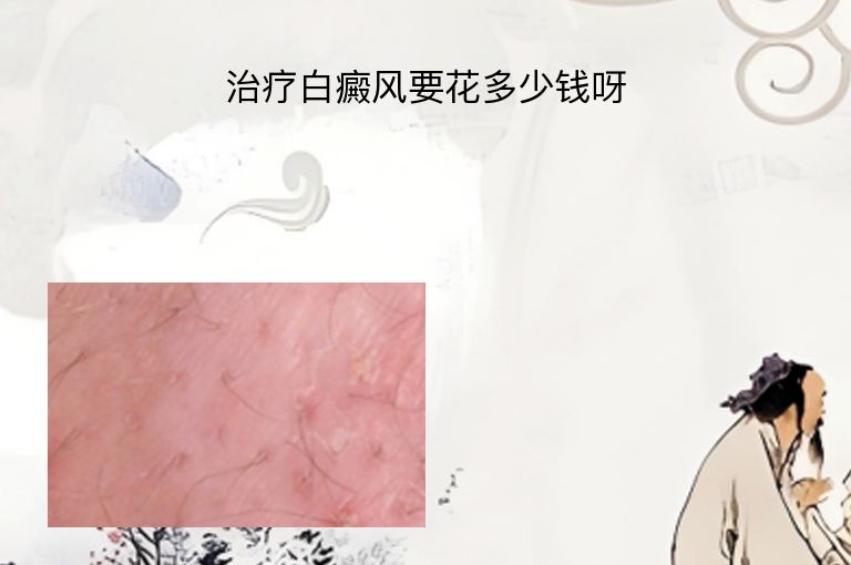 https://www.bdfsjzyy.com/d/file/p/473e1fc9137ef2337f9dffdb80ee4d42.jpeg