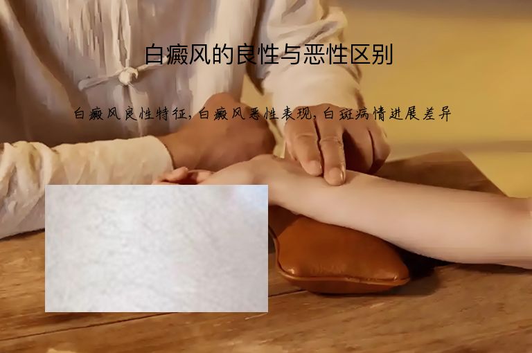 白癜风的良性与恶性区别”