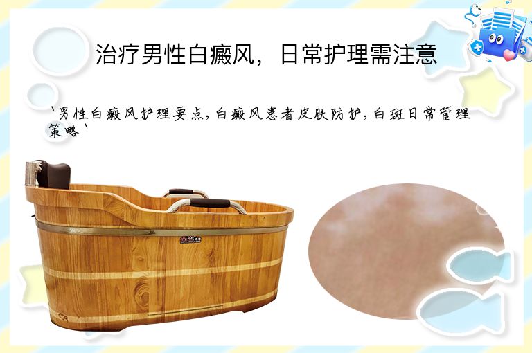 治疗男性白癜风,日常护理需注意