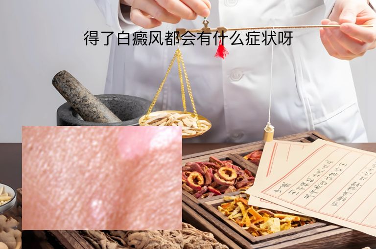 https://www.bdfsjzyy.com/d/file/p/f99300b65a4a81127e601a0023e607a6.jpeg
