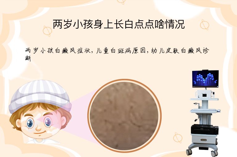 两岁小孩身上长白点点啥情况”