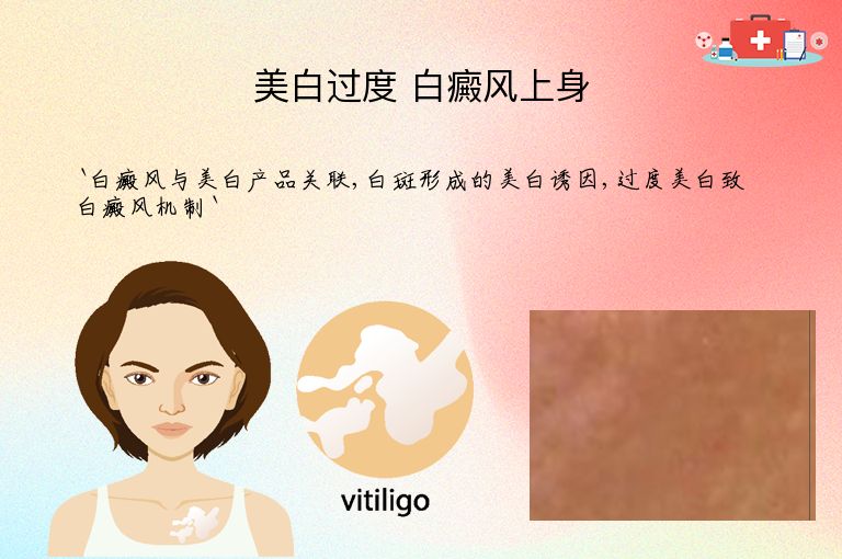 https://www.bdfsjzyy.com/d/file/p/26003480d9a6c09a44af31a20a8cbb6d.jpeg