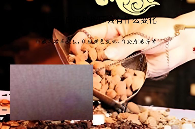 白癜风白斑处按压会有什么变化”
