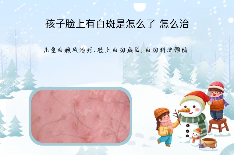 孩子脸上有白斑是怎么了 怎么治”