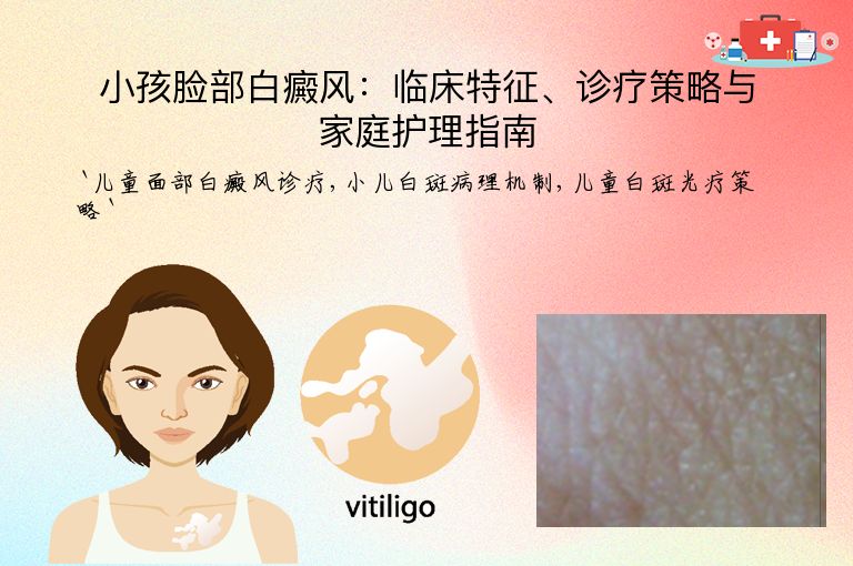 小孩脸部白癜风：临床特征、诊疗策略与家庭护理指南”