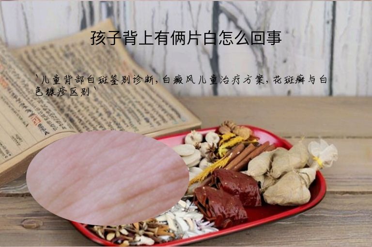 孩子背上有俩片白怎么回事