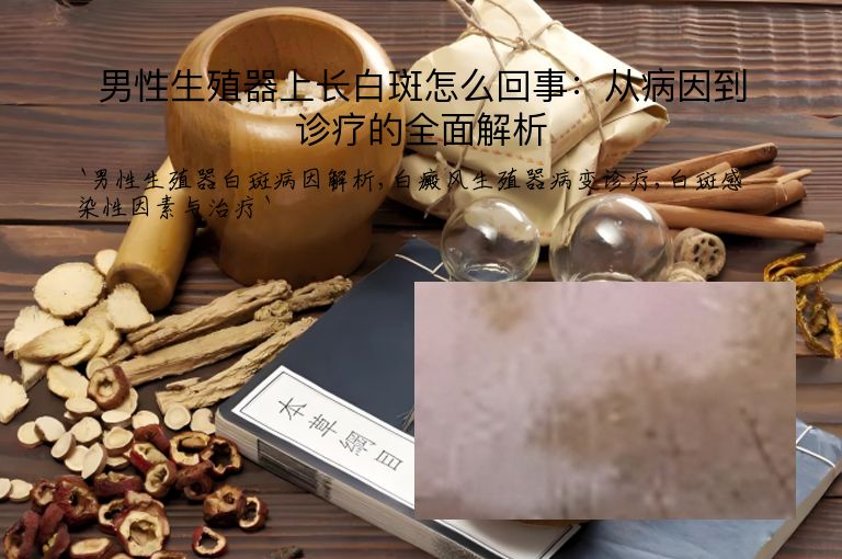 男性生殖器上长白斑怎么回事：从病因到诊疗的全面解析