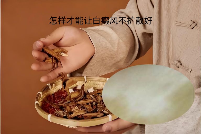 怎样才能让白癜风不扩散好