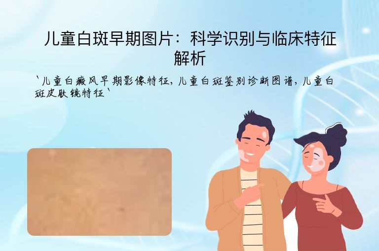 儿童白斑早期图片:科学识别与临床特征解析