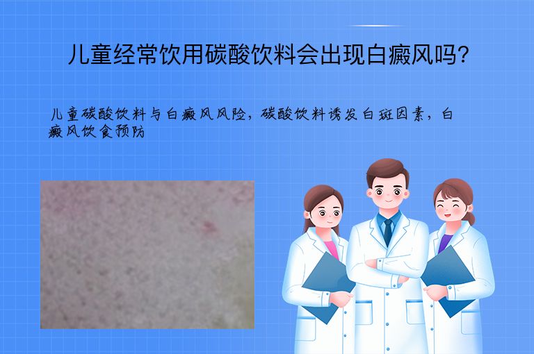 儿童经常饮用碳酸饮料会出现白癜风吗?”