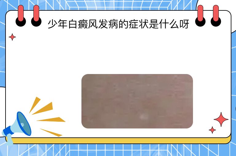 少年白癜风发病的症状是什么呀