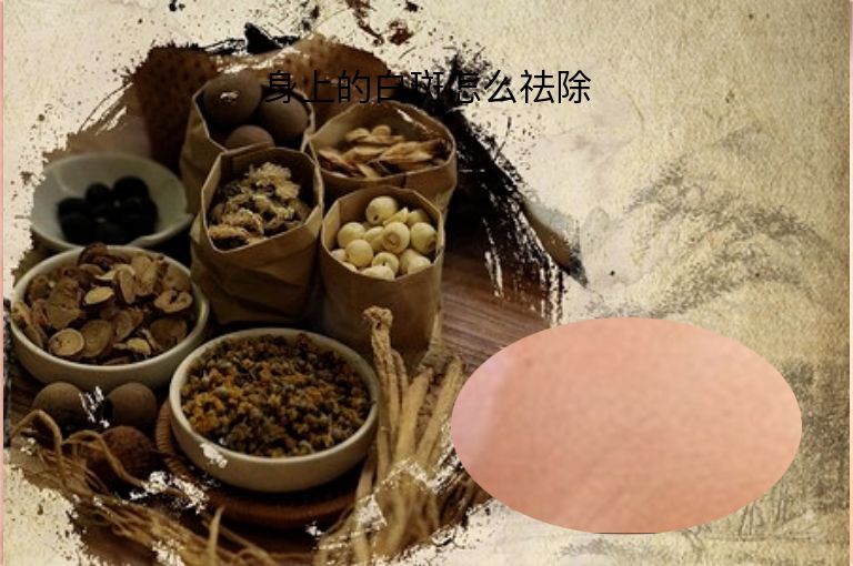 身上的白斑怎么祛除”