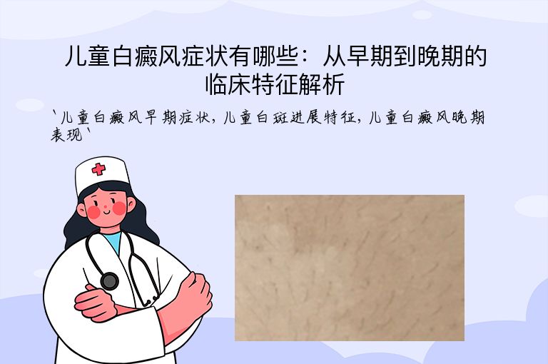 儿童白癜风症状有哪些：从早期到晚期的临床特征解析