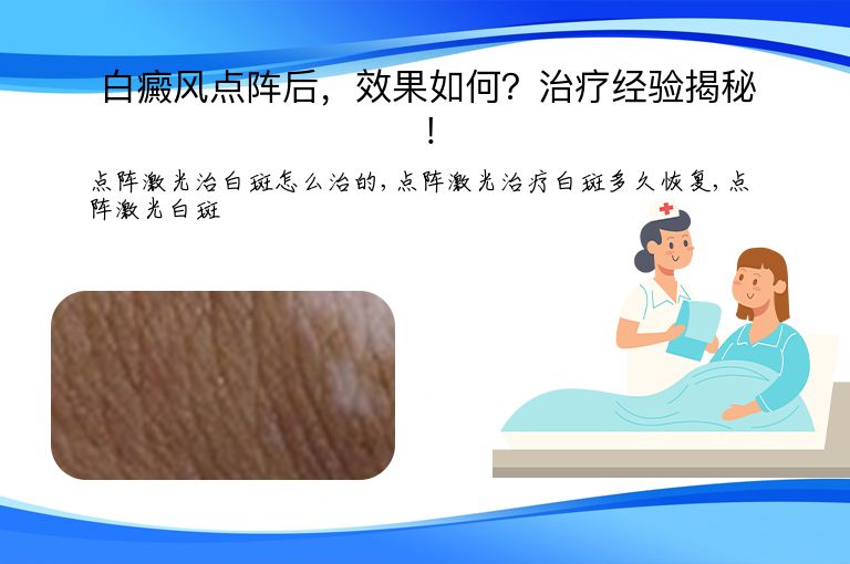 白癜风点阵后，效果如何？治疗经验揭秘！”