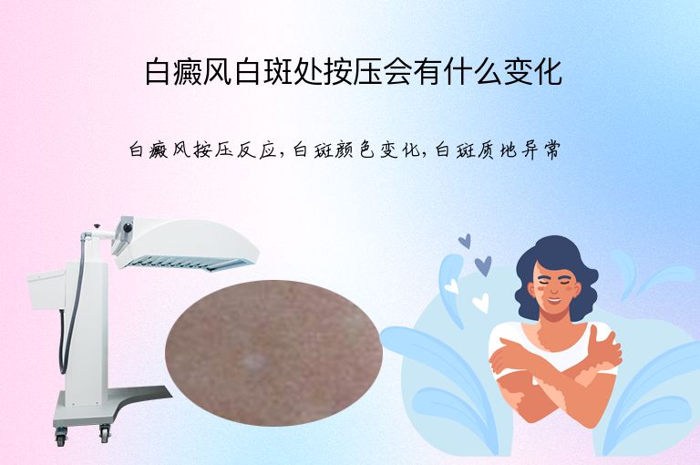 白癜风白斑处按压会有什么变化”