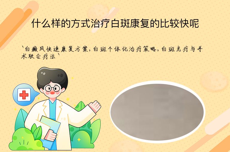 什么样的方式治疗白斑康复的比较快呢
