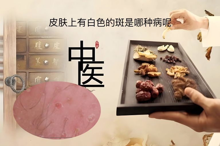 https://www.bdfsjzyy.com/d/file/p/6bafc5d9925c45a86c7f8c8f2b80881f.jpeg