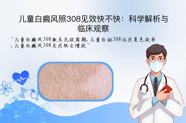 儿童白癜风照308见效快不快:科学解析与临床观察