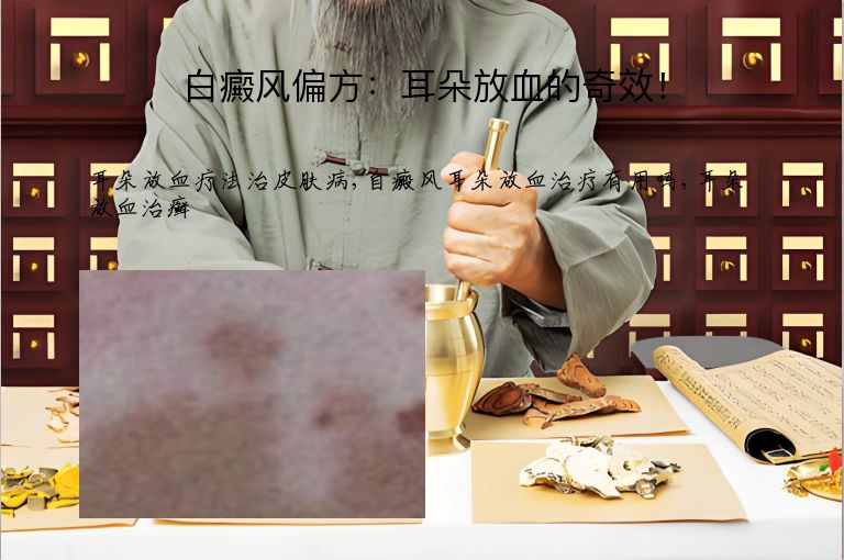 白癜风偏方：耳朵放血的奇效！”