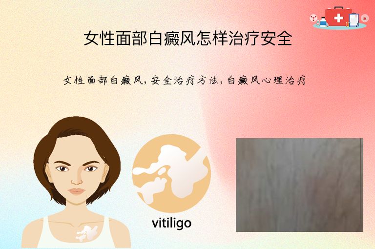 女性面部白癜风怎样治疗安全”