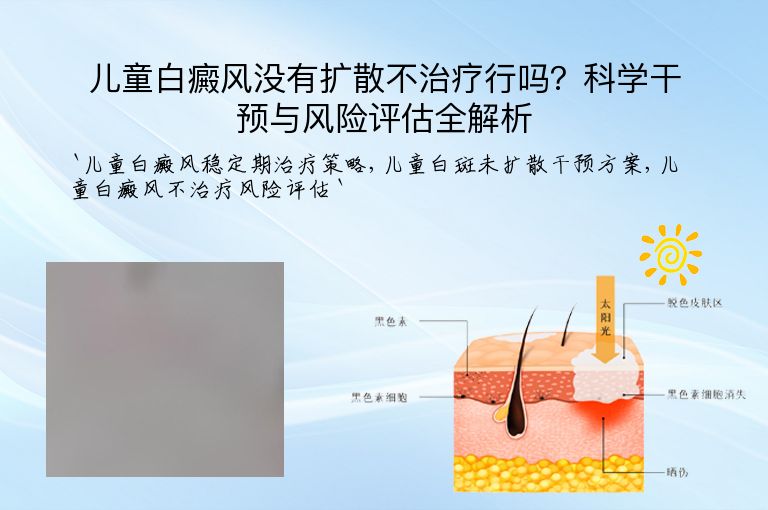 儿童白癜风没有扩散不治疗行吗?科学干预与风险评估全解析
