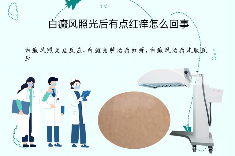 白癜风照光后有点红痒怎么回事”