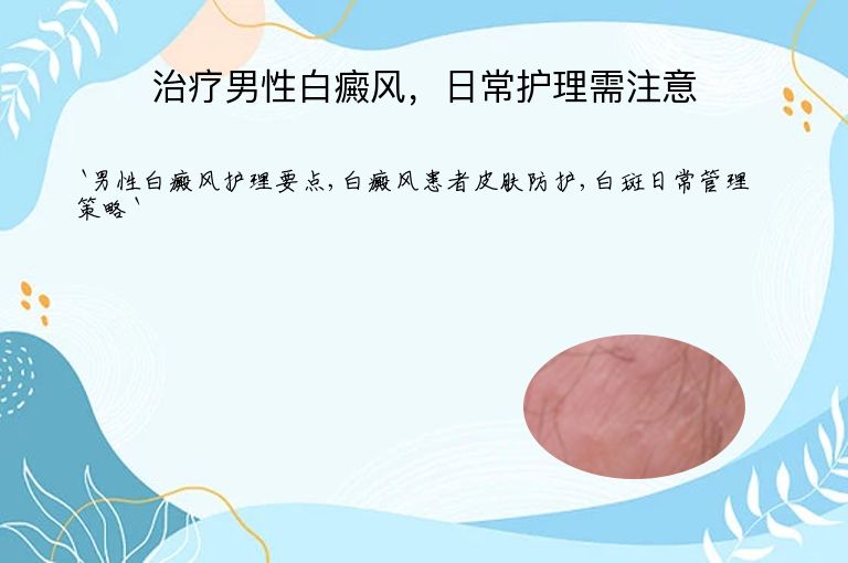 治疗男性白癜风，日常护理需注意
