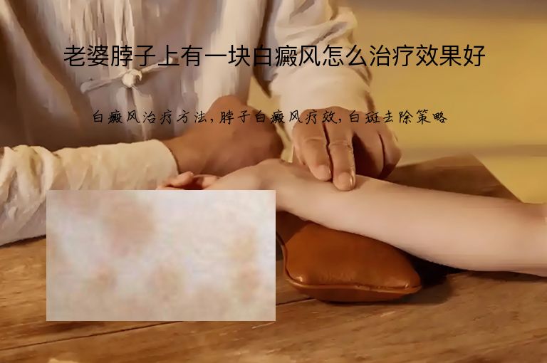 https://www.bdfsjzyy.com/d/file/p/486f7e55561db9e17f0f385df10e4d09.jpeg