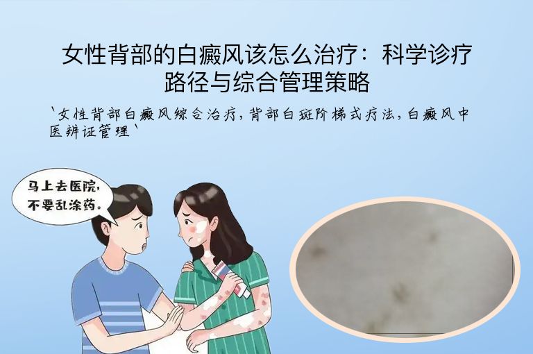 女性背部的白癜风该怎么治疗：科学诊疗路径与综合管理策略