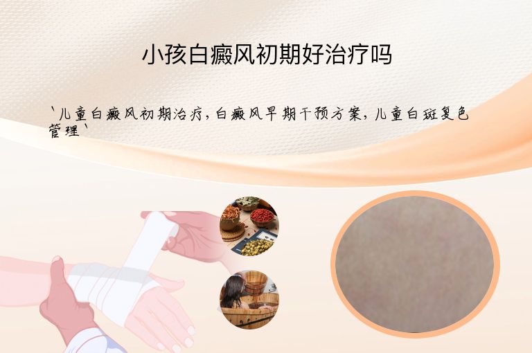 小孩白癜风初期好治疗吗
