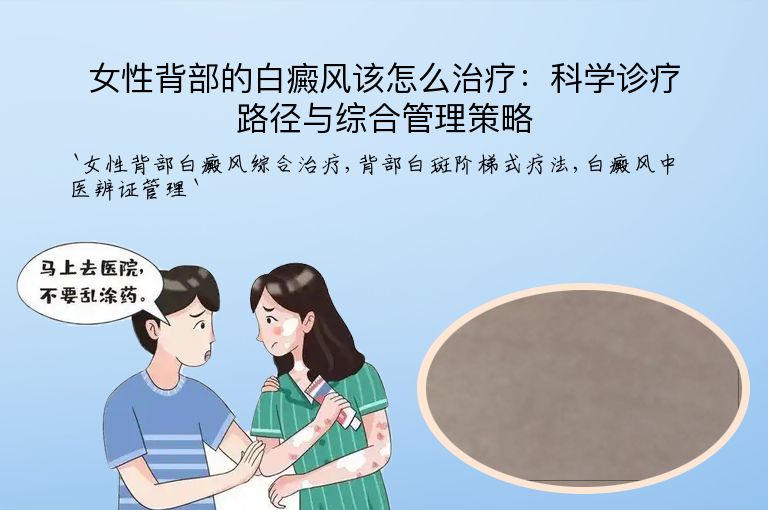 女性背部的白癜风该怎么治疗：科学诊疗路径与综合管理策略