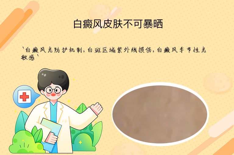 白癜风皮肤不可暴晒