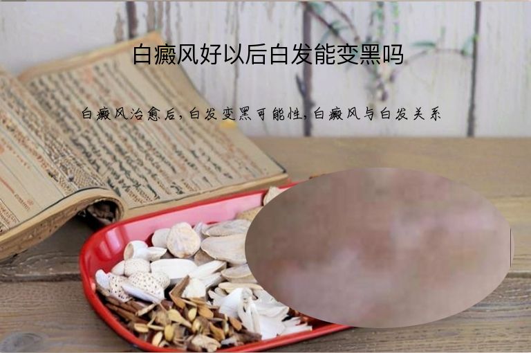 https://www.bdfsjzyy.com/d/file/p/03af7506a7e7b25fadd10264fb90502c.jpeg