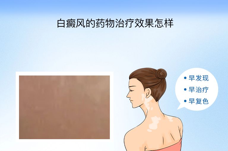 https://www.bdfsjzyy.com/d/file/p/5a27c43a4f5c9082c8d190a347aa5f23.jpeg