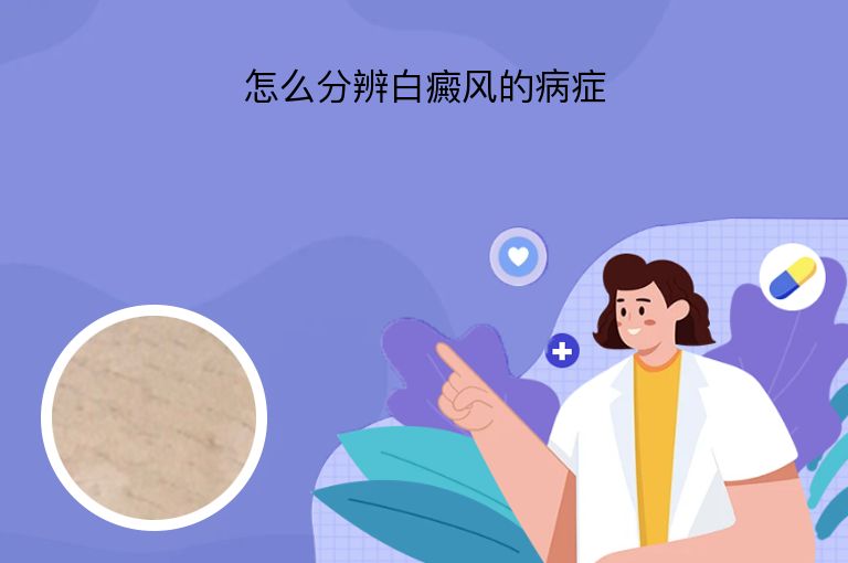 https://www.bdfsjzyy.com/d/file/p/58b7f0aa74d11b4e36655b98aa1ef9eb.jpeg