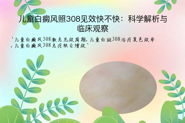 儿童白癜风照308见效快不快:科学解析与临床观察