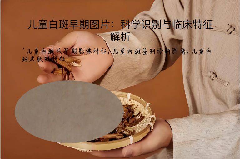 儿童白斑早期图片：科学识别与临床特征解析