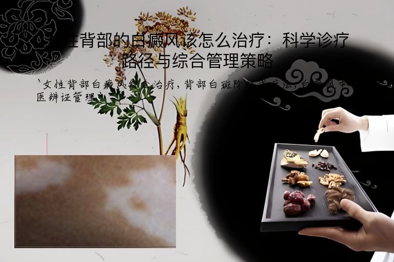 女性背部的白癜风该怎么治疗：科学诊疗路径与综合管理策略